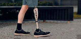 Як отримати протезування та як обрати протезиста